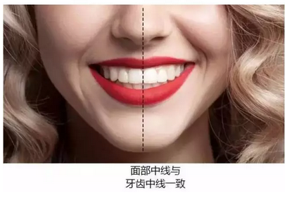 中线一致说明牙齿整齐自测方法:牙齿中线是测试牙齿整齐程度的参考